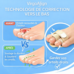 Correcteur d'Orteil VirgoAlign Pro