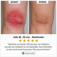 DermaVie 14