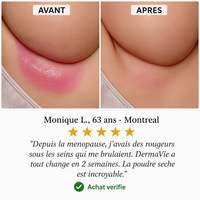 DermaVie 3