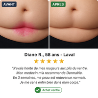DermaVie 9