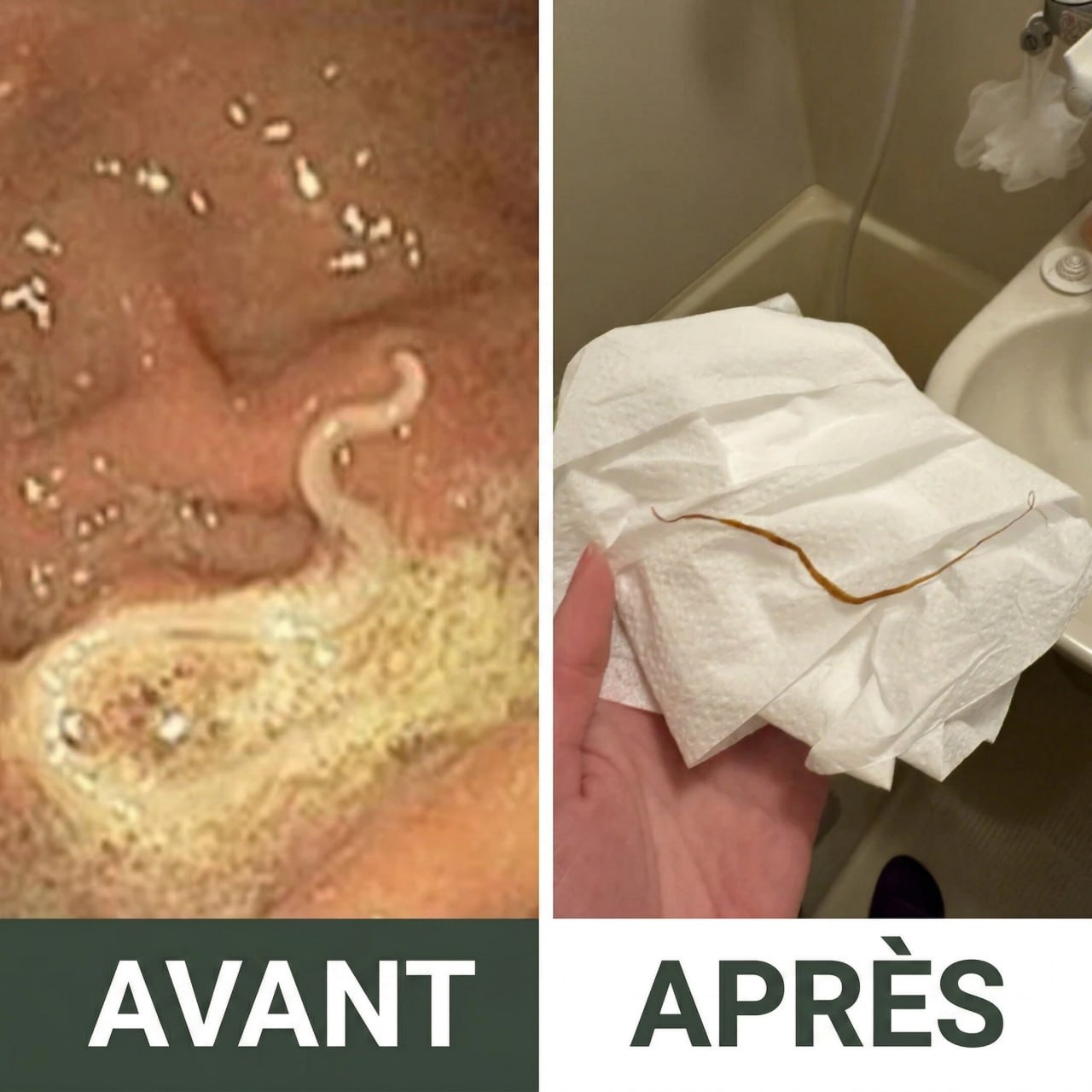 Ensemble Detox Huile de Ricin