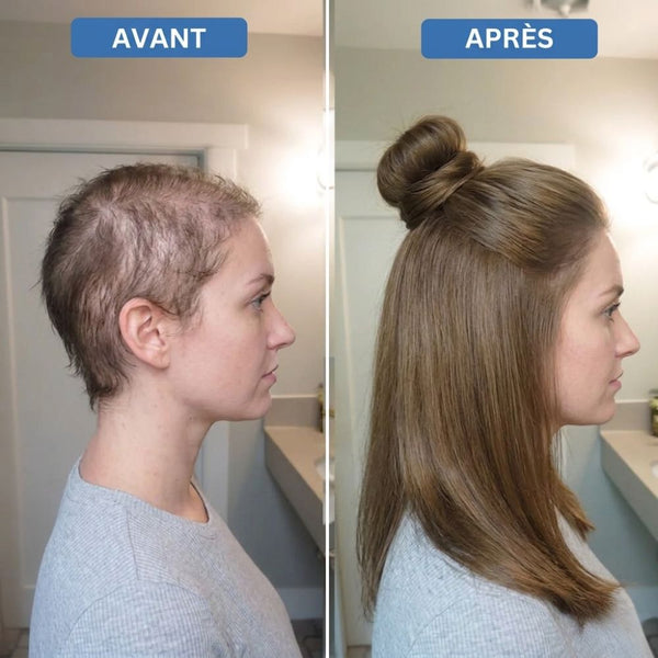 Soutient des Cheveux Plus Forts et Plus Sains