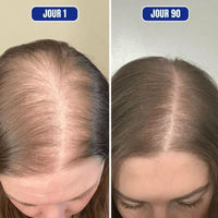 Masseur de Tete Electrique - Petrissage Profond & Soutien a la Croissance Capillaire