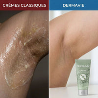 DermaVie 2