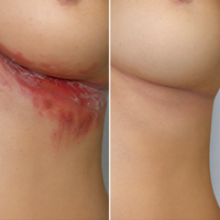 DermaVie 16