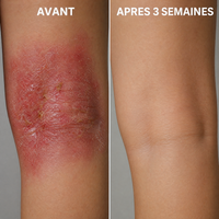 DermaVie 5