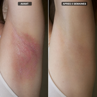 DermaVie 7