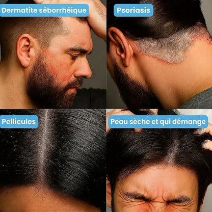 Restora - Baume Réparateur Barbe & Peau