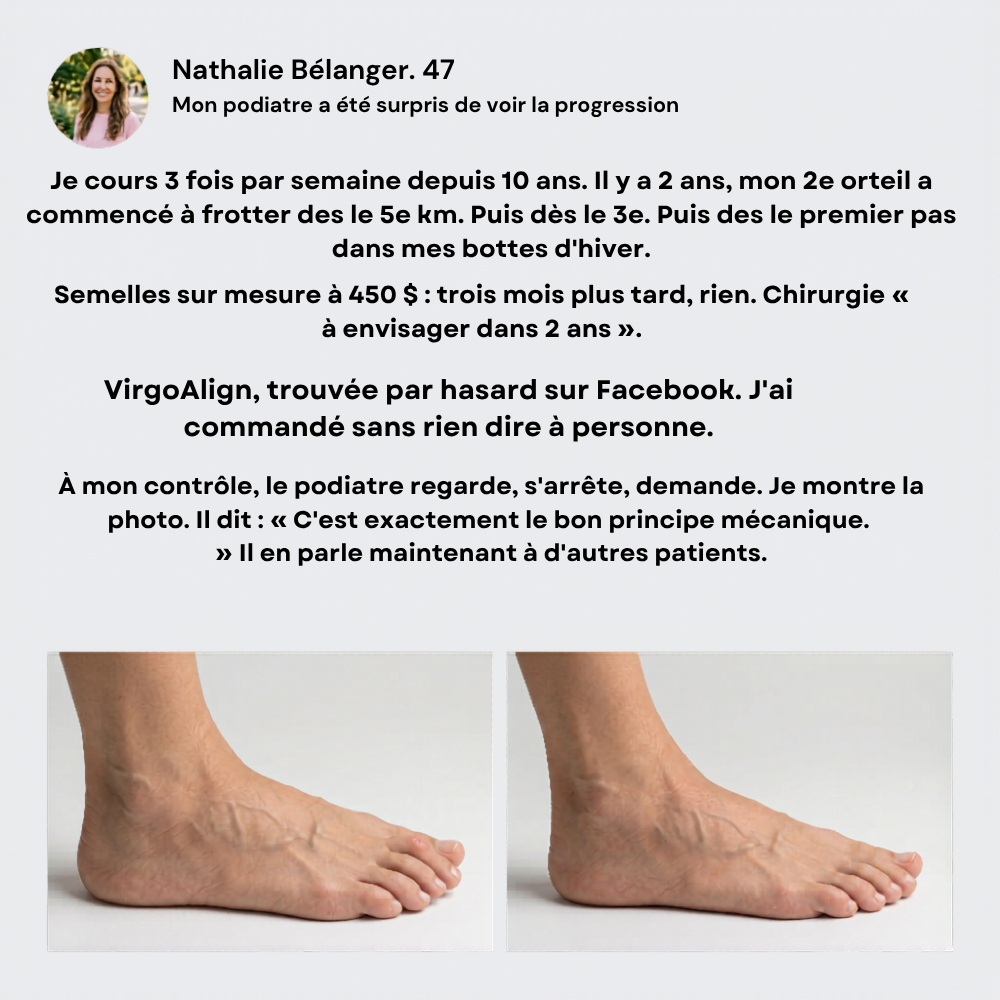 Correcteur d'Orteil VirgoAlign Pro