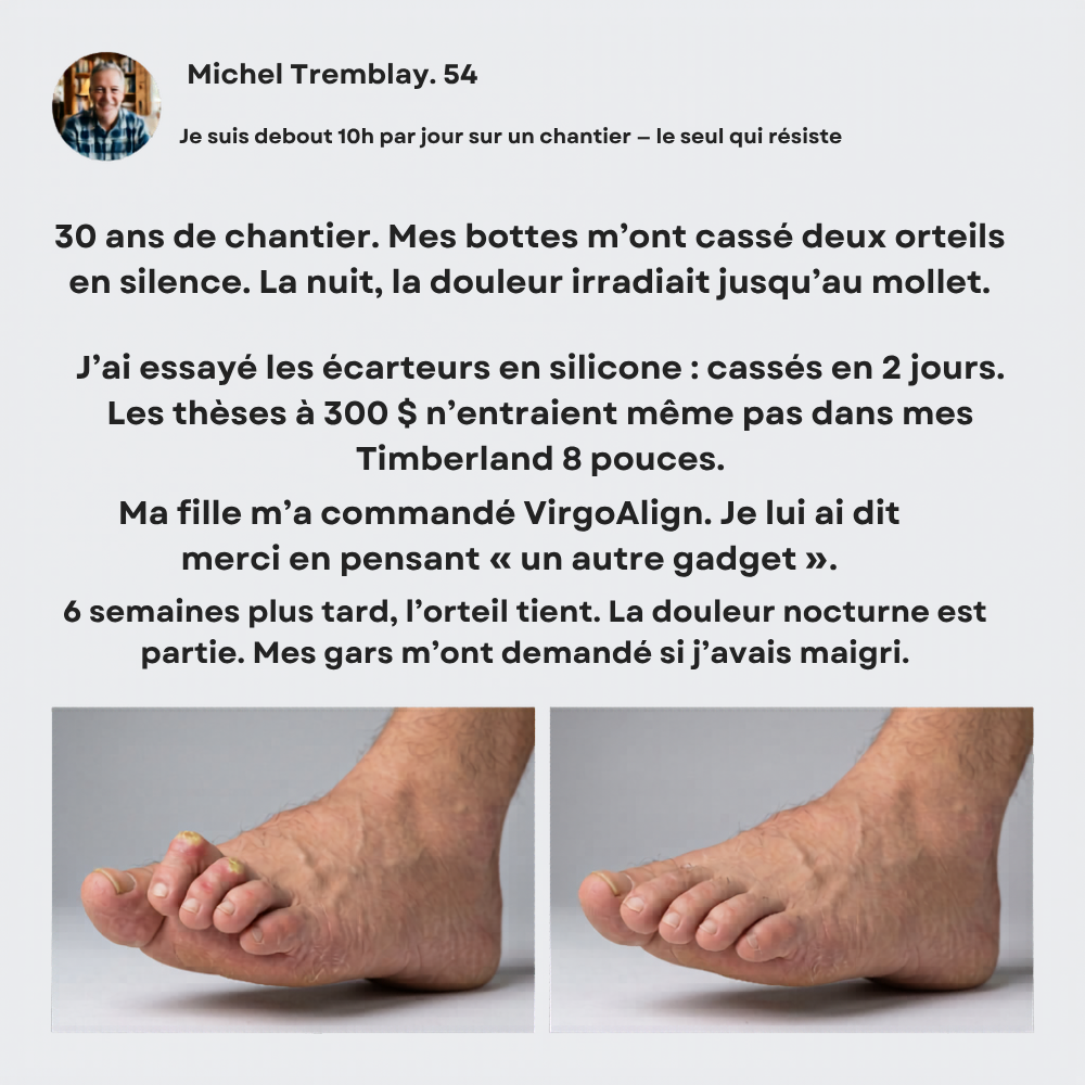 Correcteur d'Orteil VirgoAlign Pro