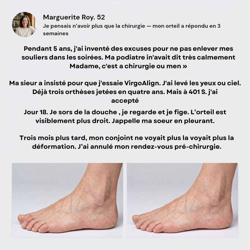Correcteur d'Orteil VirgoAlign Pro