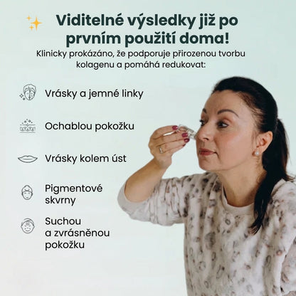 Micro-Infusion Lift Pro - Results