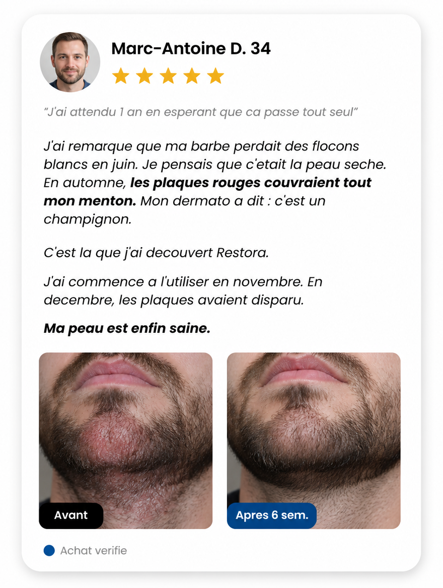 Avis client Marc-Antoine D. - Dermatite seborrheique eliminee en 6 semaines