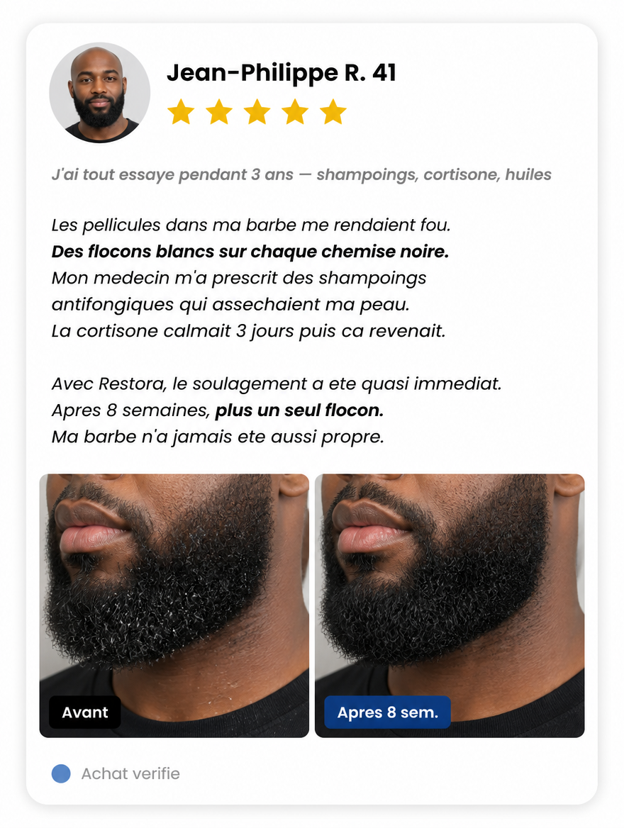 Avis client Jean-Philippe R. - Pellicules de barbe eliminees en 8 semaines