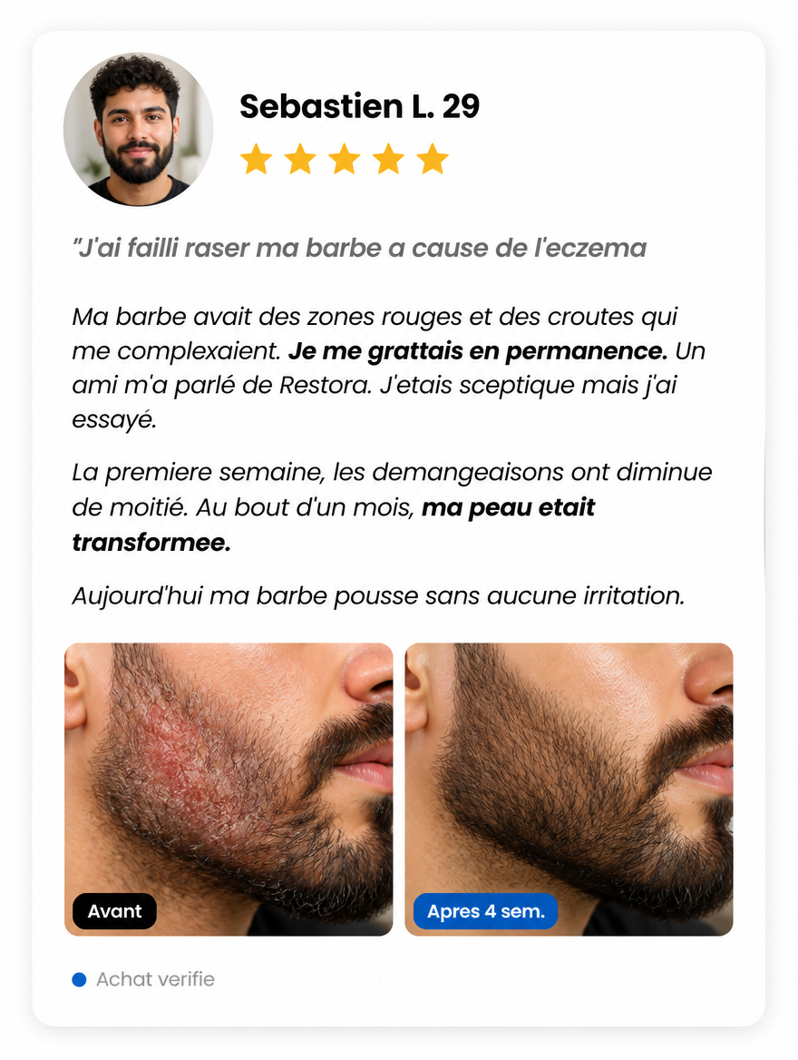 Avis client Sebastien L. - Eczema sec disparu en 4 semaines