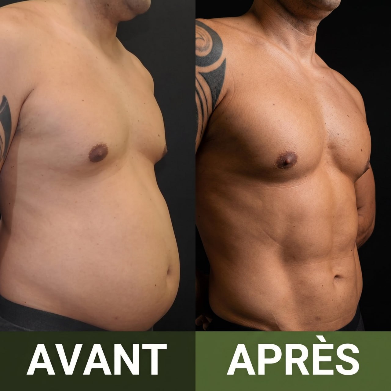 Ensemble Detox Huile de Ricin