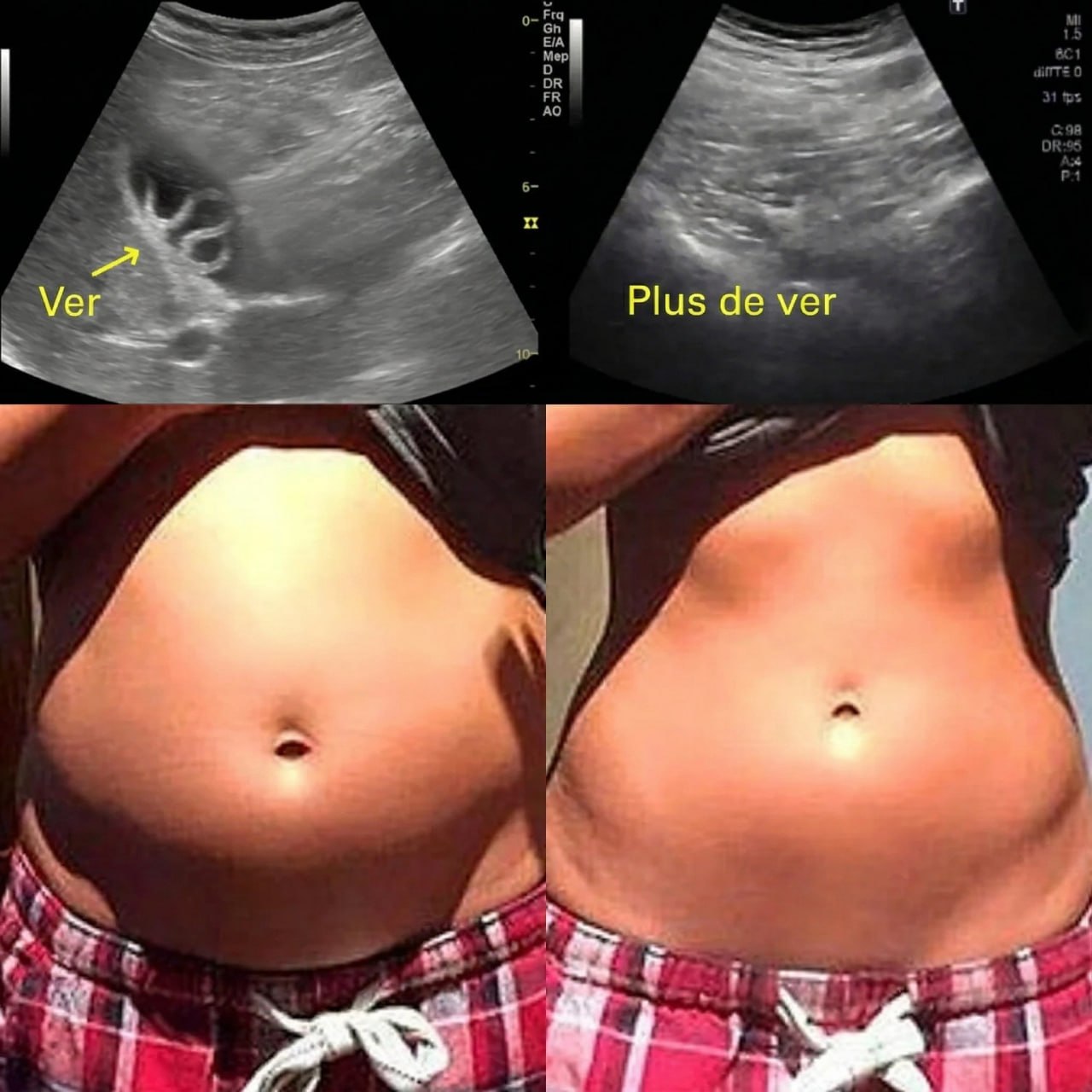 Ensemble Detox Huile de Ricin